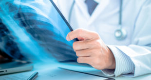 Akciger-Kanseri_saglik