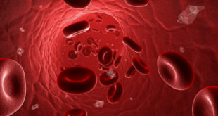 Kan_pihti_damar_tikanikligi