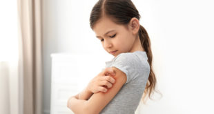 Çocuklarda Ciddiye Alınması Gereken Döküntüler