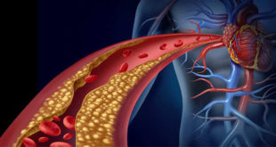 Damar Hastalıklarına Erken Müdahale Damar Check-Up’ı
