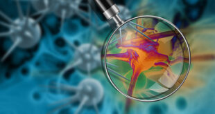 Kanser Hakkında Doğru Sanılan 8 Yanlış!